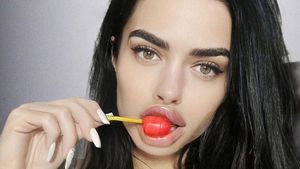 8 Foto Artis Rusia Minta Donasi untuk Perbaiki Hidung yang Gagal Oplas