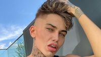 7 Foto Pria yang Habis Operasi Plastik Malah Diejek Mirip Squidward