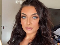 Wanita Ini Alami Kondisi Langka Seperti Film 50 First Dates di Dunia Nyata