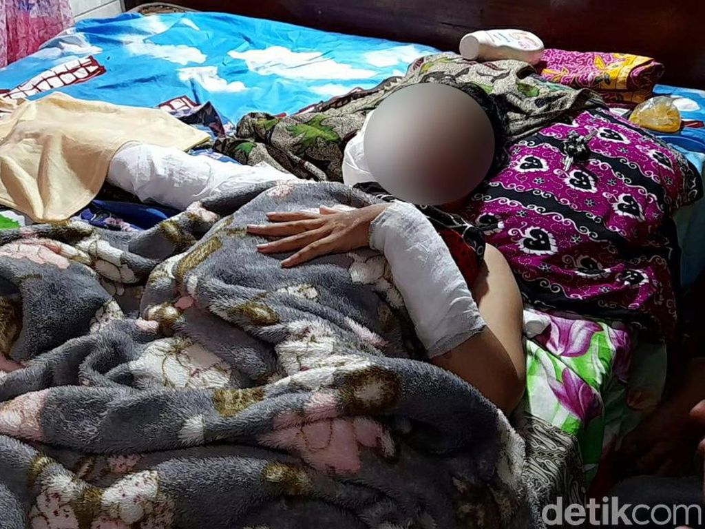 Siswi SMK yang Disiram Cairan Misterius Saat COD Bakal Operasi Plastik Siswi SMK yang Disiram Cairan Misterius Saat COD Bakal Operasi Plastik
