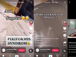 Viral Mahasiswi Kena Piriformis Syndrome, Begini Cara Mencegahnya