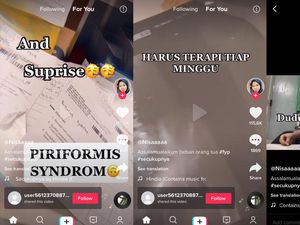 Viral Diidap Mahasiswi Gegara Kuliah Online, Ini Fakta Piriformis Syndrome Viral Diidap Mahasiswi Gegara Kuliah Online, Ini Fakta Piriformis Syndrome