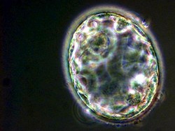 Ilmuwan AS-Australia Berhasil Ciptakan Model Embrio Manusia