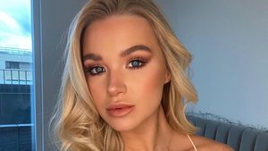 8 Foto Wajah Flawless Selebgram Sebelum Terkena Bola Api Saat Bikin Konten
