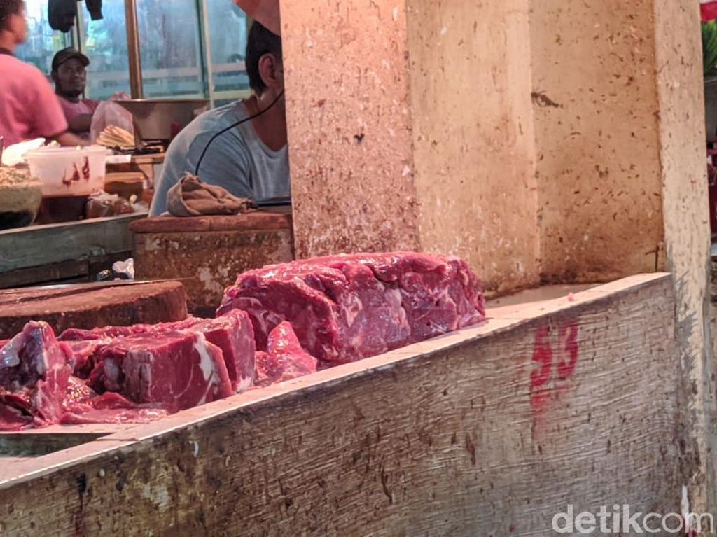Hobi Makan Daging Mentah, Perut Pria Ini Digerogoti Cacing Pita 18 Meter
