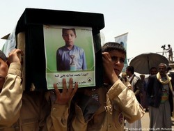 Melihat Lebih Dekat Anak-anak Korban Perang di Yaman