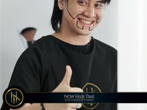 7 Foto Kevin Aprilio Cangkok Rambut di Turki, Sempat Tampil Botak 7 Foto Kevin Aprilio Cangkok Rambut di Turki, Sempat Tampil Botak