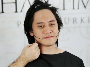 Mengenal Cangkok Rambut Seperti yang Dilakukan Kevin Aprilio Mengenal Cangkok Rambut Seperti yang Dilakukan Kevin Aprilio