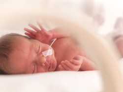 RI Peringkat 5 Tertinggi Kelahiran Bayi Prematur di Dunia, Kok Bisa?