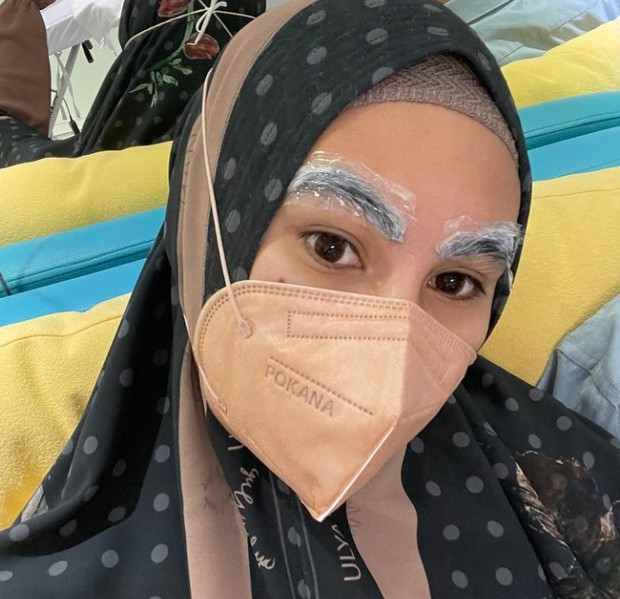 Foto: Kartika Putri/instagram.com/kartikaputriworld Laser Alis, Metode Hilangkan Sulam Alis yang Dilakukan Kartika Putri