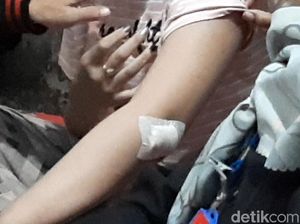 Cerita Ibu-Anak di Tasikmalaya Duel Lawan Pencuri Bersenjata Tajam