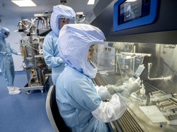 Virus Marburg Muncul Lagi Picu 6 Orang Tewas, Seserius Ini Gejalanya