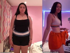 Keren! Diejek Mirip Kuda Nil, Remaja Ini Sukses Diet Turun BB 31 Kg