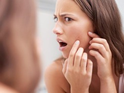 Lagi Jerawatan? Hindari 4 Makanan Ini Agar Jerawat Tak Makin Parah