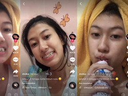 Gigi Dikunci Gara-gara Kecelakaan, 2 Minggu Cuma Bisa Minum Susu-Obat Maag