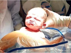 Bayi Viral Karena Lahir Dengan Muka Cemberut, Begini Wajahnya Sekarang