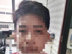 Ibu Rumah Tangga Ini Diperas Dokter Gadungan yang Ancam Sebar Foto Bugilnya