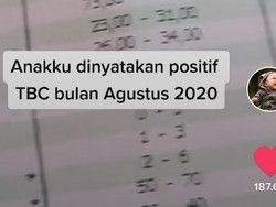 Viral Cerita Bayi Kena TBC Diduga karena Dicium Orang Lain