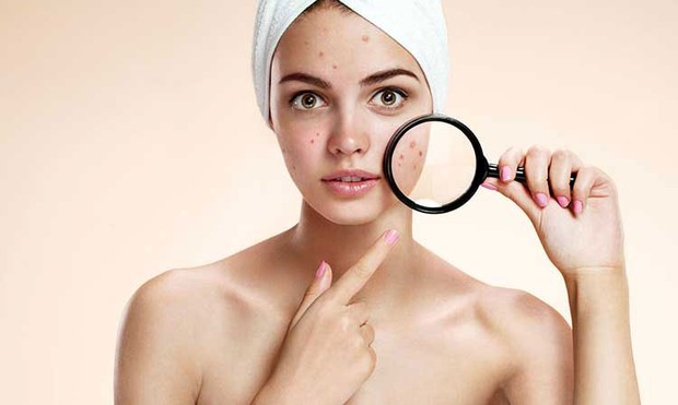 Kulit mengalami breakout/ciinmagazine.com