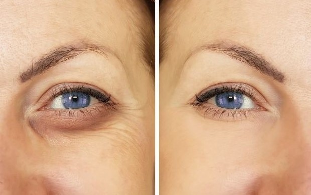 Foto:pinterest/thebeautydeeplife