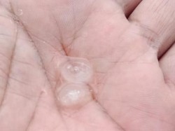 Hujan Es Terjadi di Pakem Sleman