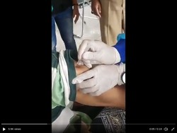 Viral Kakek Kebal Jarum Suntik yang Bikin Komnas KIPI Terheran-heran
