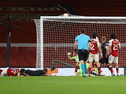 Arsenal Bikin Arteta Kecewa