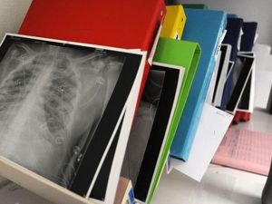 Pertama di Dunia, Pasien Corona Terima Cangkok Paru-paru dari Pendonor Hidup