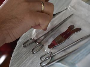 Sunat Perempuan Masih Marak Dilakukan, Ini 5 Risikonya Menurut Dokter