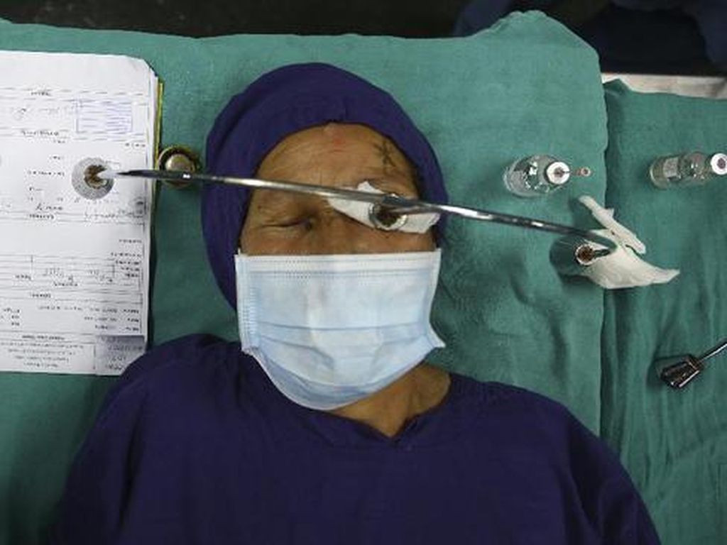 Ambisi Dokter Mata Berantas Katarak di Nepal