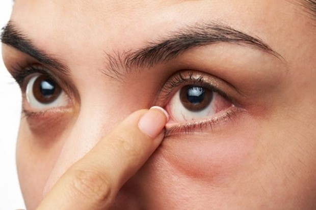 foto: Iritasi Mata/freepik.com foto: Iritasi Mata/freepik.com