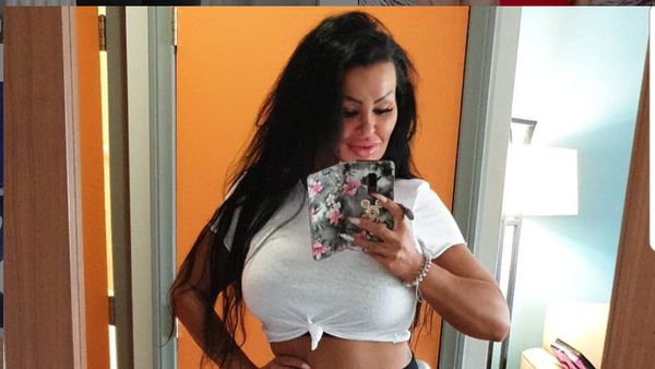 8 Foto Wanita Terobsesi Oplas, Habiskan Rp 5 M untuk 8 Kali Operasi Payudara