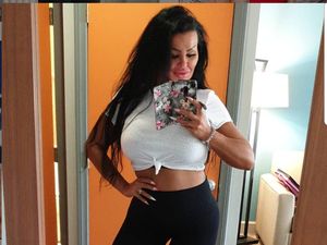 8 Foto Wanita Terobsesi Oplas, Habiskan Rp 5 M untuk 8 Kali Operasi Payudara