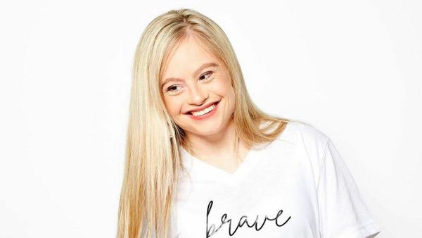 10 Potret Model Down Syndrome yang Terobsesi Tampil di Majalah Pria Dewasa