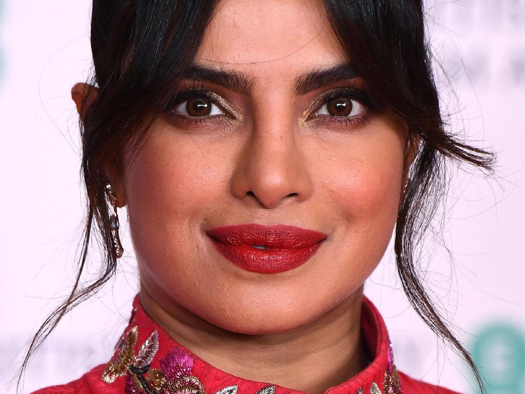 Begini Penampilan Wajah Artis Bollywood yang Mengaku Operasi Plastik Begini Penampilan Wajah Artis Bollywood yang Mengaku Operasi Plastik