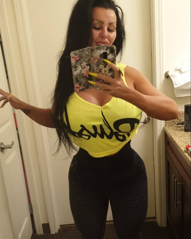 Penampilan setelah operasi plastik/Instagram.com/krystinajamieson Penampilan setelah operasi plastik