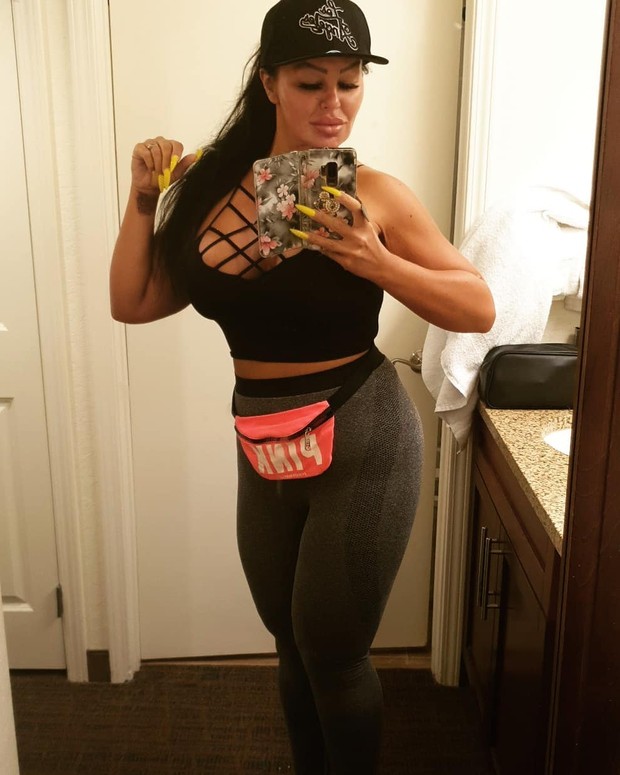 Penampilan setelah operasi plastik/Instagram.com/krystinajamieson Penampilan setelah operasi plastik