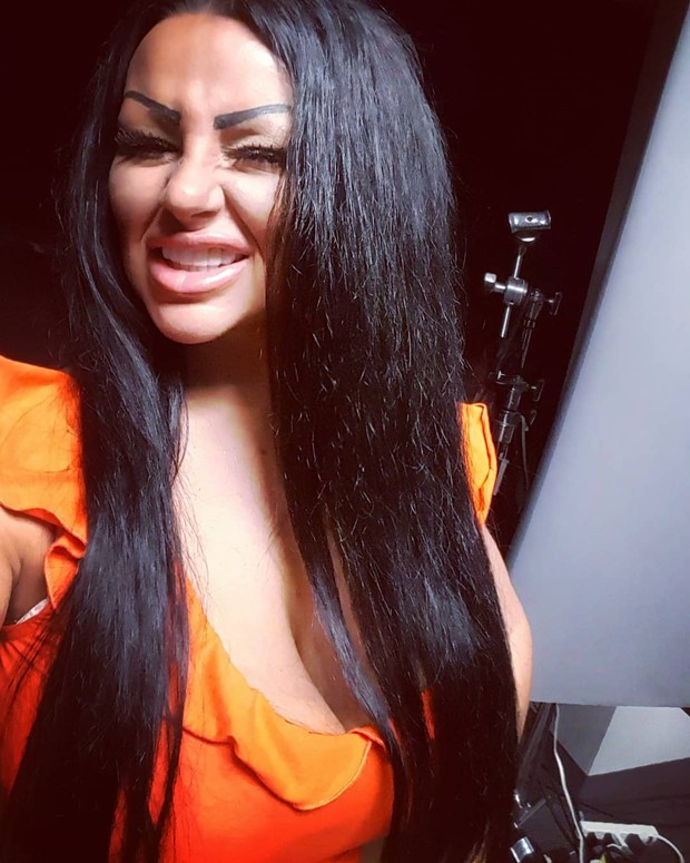 Penampilan setelah operasi plastik/Instagram.com/krystinajamieson Penampilan setelah operasi plastik