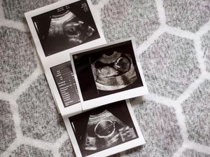 Lewat Bayi Tabung, Pasutri Bisa Pilih Jenis Kelamin Calon Bayi