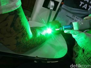 Layanan Hapus Tato Gratis di Bulan Suci Ramadhan