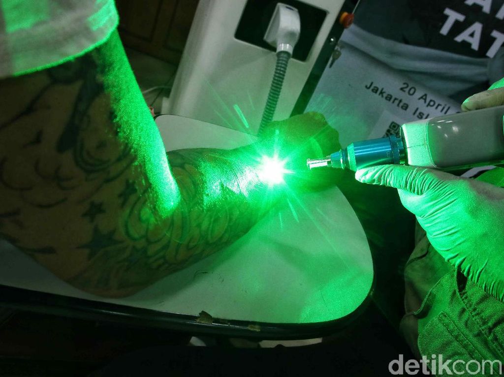 Layanan Hapus Tato Gratis di Bulan Suci Ramadhan Layanan Hapus Tato Gratis di Bulan Suci Ramadhan