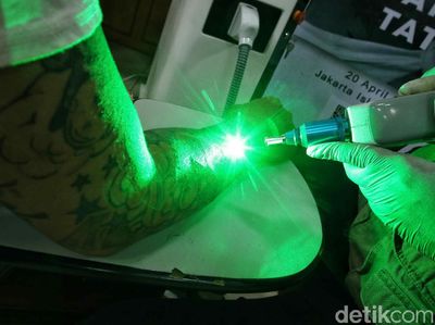 Layanan Hapus Tato Gratis di Bulan Suci Ramadhan