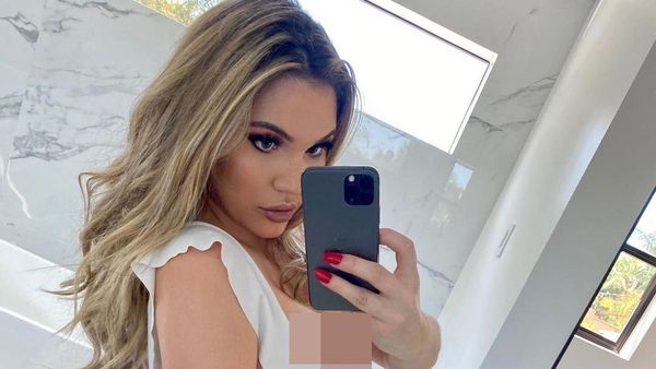 Foto: Model yang Menyesal Operasi Bokong Sampai Jadi Depresi