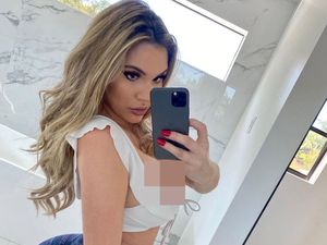 Foto: Model yang Menyesal Operasi Bokong Sampai Jadi Depresi