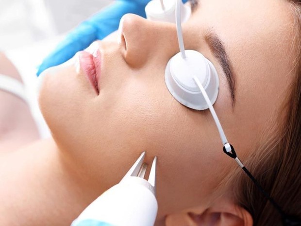 Ilustrasi treatmenacne scar Foto:pinterest/stylecraze