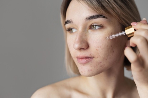 Skincare Mengandung Retinol