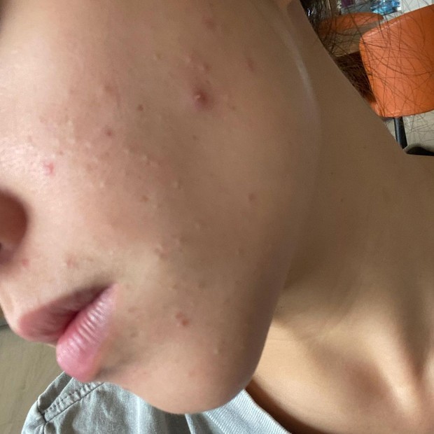 Mulai Breakout/instagram.com/nikitawillyofficial94