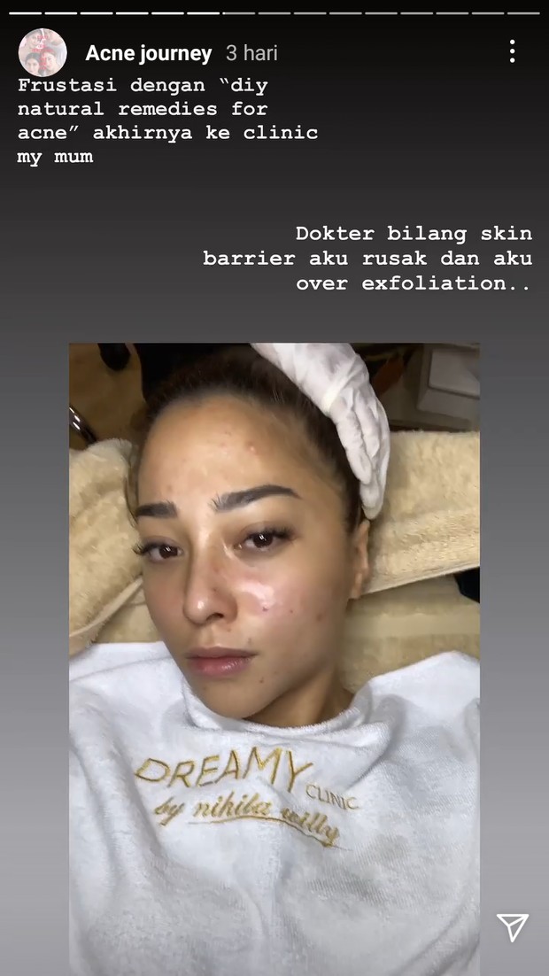 Nikita Willy memutuskan melakukan perawatan ke klinik untuk masalah wajahnya/instagram.com/nikitawilly94