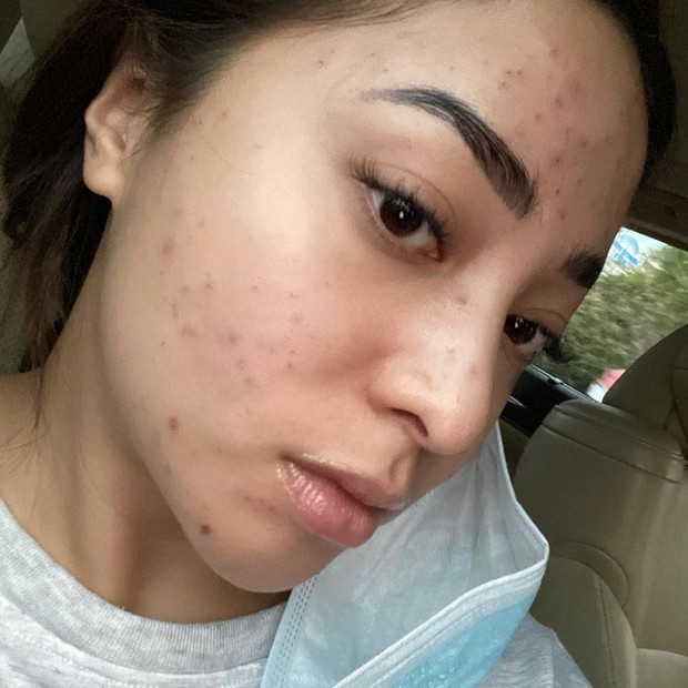 Nikita Willy mecoba menangani dengan rajin cuci muka, scrubbing /instagram.com/nikitawilly94