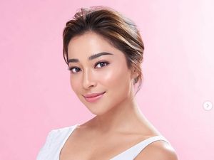 8 Foto Artis Cantik Indonesia saat Pamer Jerawat, Tetap Memukau! 8 Foto Artis Cantik Indonesia saat Pamer Jerawat, Tetap Memukau!